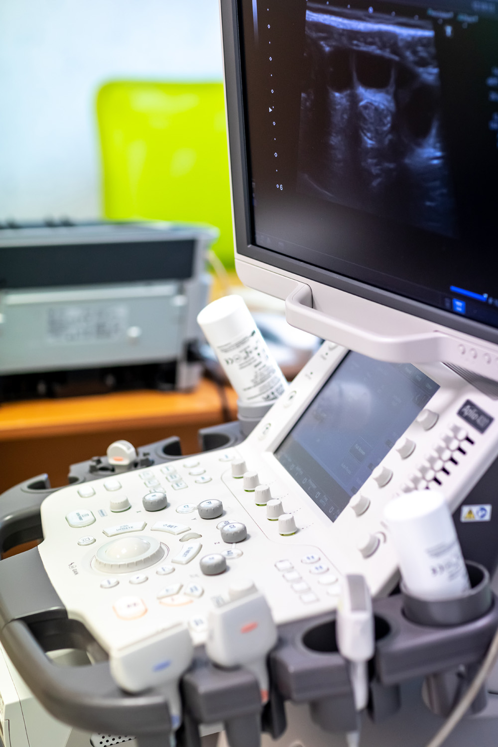 Pořízení ultrazvukových přístrojů